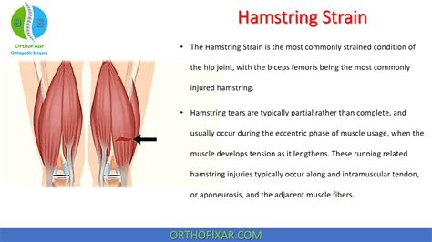 test for hamstring tear|different types of hamstring strains.